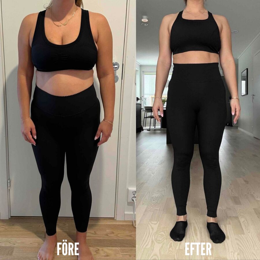 Före och efter, klientresultat hos Zahra Ajami