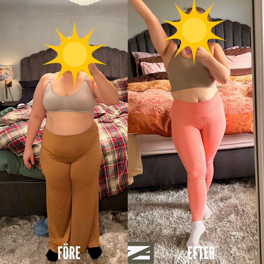 Före och efter, klientresultat hos Zahra Ajami